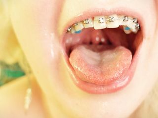 consuming in braces – vore and meals fetish – shut up video