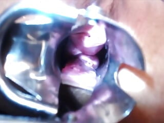 Speculum Cervix & Anal Examination Nice View Inside of